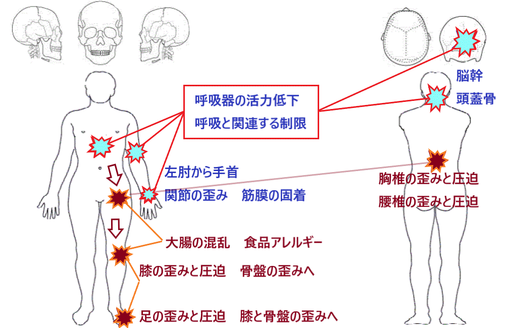 胸の痛みに対するオステオパシーの整体例 なぜ大腸の回復まで必要なのか 東京オステオパシー フローティング 神楽坂 飯田橋
