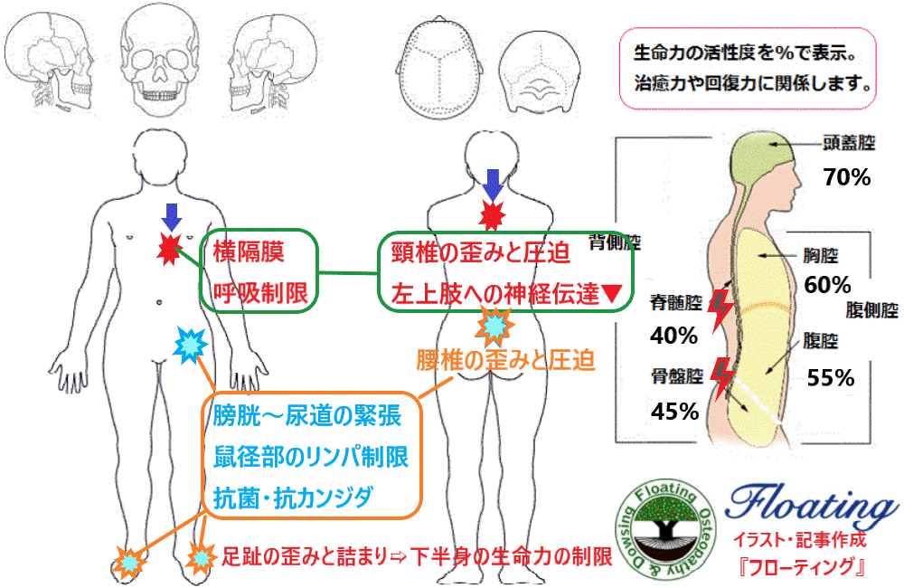 肘の痛みと手の痺れに対するオステオパシーの整体例