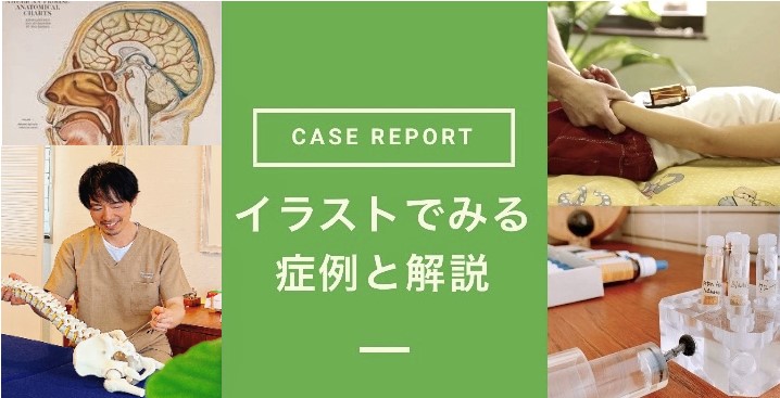 オステオパシーの症例と解説のイメージ画像